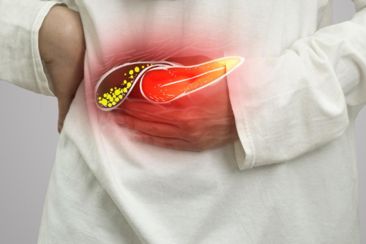 Gallbladder Cyst